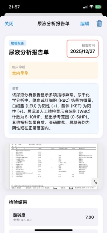 AI 智能单据识别